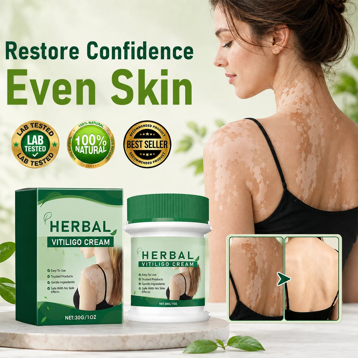 Herbal Vitiligo Cream