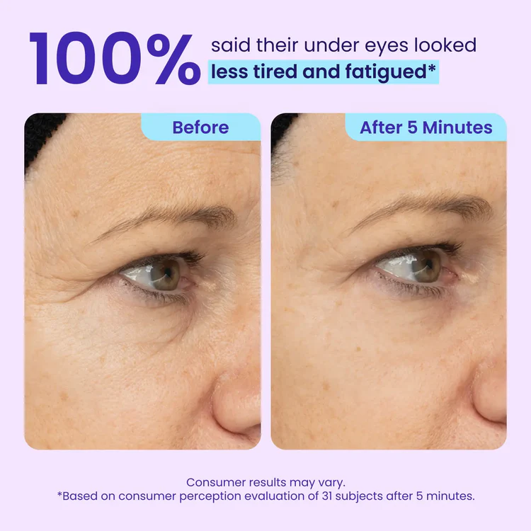 Instant Lift Eye Gel — Reduce the Look of Eye Bags in Minutes ✨