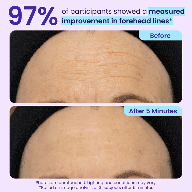 Instant Lift Eye Gel — Reduce the Look of Eye Bags in Minutes ✨