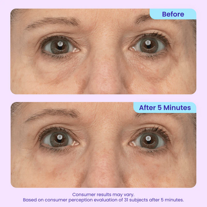 Instant Lift Eye Gel — Reduce the Look of Eye Bags in Minutes ✨
