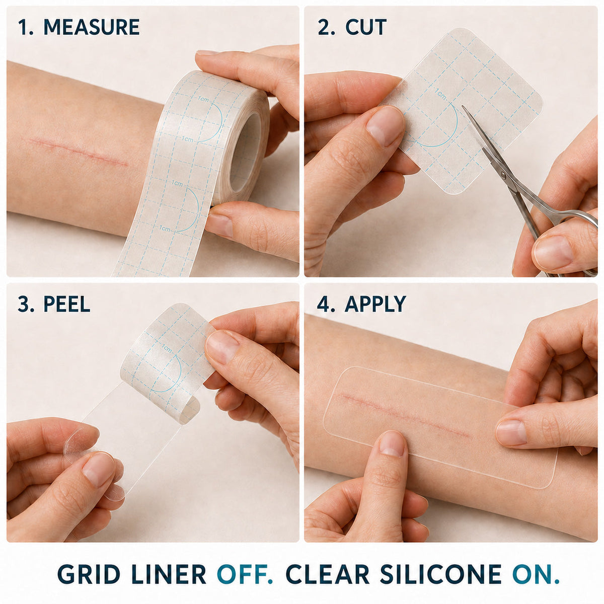 🎁🧚SILICONE SCAR THERAPY ROLL Help Soften, Flatten & Improve the Appearance of Raised Scars