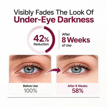 💖Trusted-by-over-50-000-women💖 Eye Renewal Crème