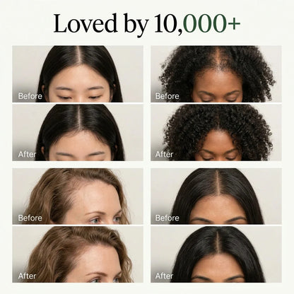 Korean Scalp Revival Bar🎉