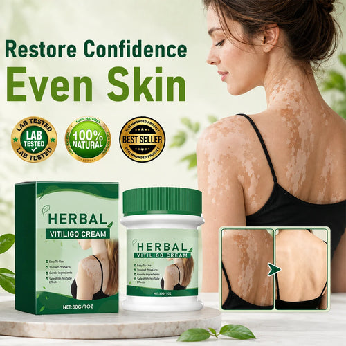 Herbal Vitiligo Cream